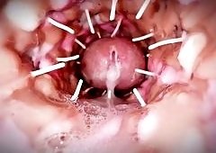TranquilBead384s Spiky Brunette Pussy Erupts Dads Cum Like H